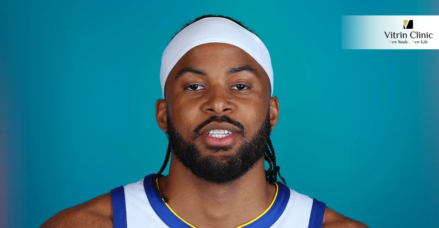 How Does Moses Moody Smile Reflect His Journey in the NBA Today?